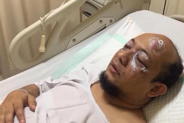 Dokter ahli kornea di Singapura bernama Donal Tan berencana menggratiskan biaya perawatan Novel sebagai bentuk simpati setelah mengetahui Novel bekerja sebagai penyidik KPK.