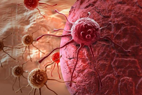 Ilmuwan telah mengembangkan tes darah baru, yang dapat mendeteksi delapan jenis kanker umum.