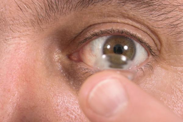 Morjaria mengungkapkan awalnya hanya 17 lensa kontak yang dikeluarkan. Ke-17 lensa kontak itu ditemukan dalam kondisi menempel