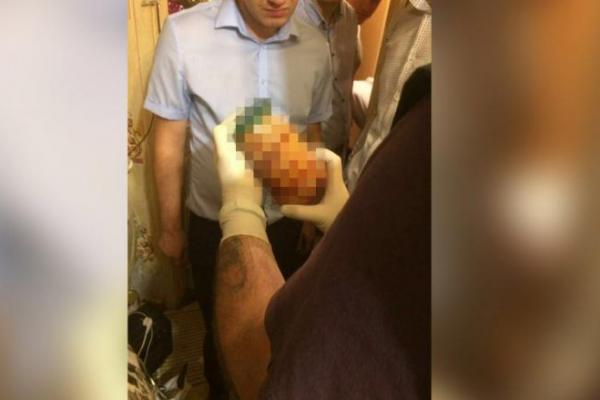 Pihak kepolisian berhasil menahan pasangan tersangka kanibal di Rusia.