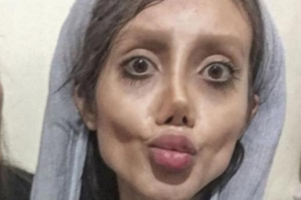 Seorang wanita Iran rela melakukan 50 kali operasi plastik agar terlihat persis bintang idolanya Angelina Jolie