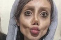 Ingin Mirip Angelina Jolie, Muka Wanita Ini Jadi Serem