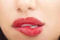Simak Enam Cara Atasi Bibir Menghitam