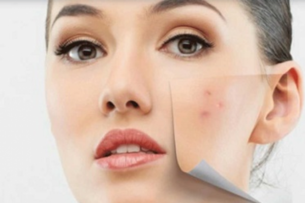 Apa yang akan terjadi pada kulit kita bila alergi disebabkan oleh kosmetik? Yuk cari tahu penyebabnya