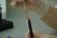 Ilmuwan Temukan Tes Darah Bisa Prediksi Siklus Penuaan