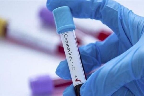 Warga tersebut dikabarkan menemani orang yang dilaporkan pada Senin (2/3) sebagai kasus pertama virus corona di Arab Saudi.