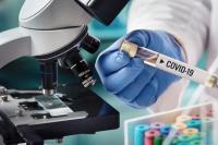 Studi: Hati-hati, Tes PCR Juga Tidak Akurat Deteksi Covid-19