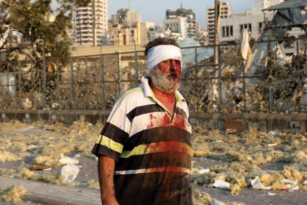 300.000 warga Lebanon telah menjadi tunawisma setelah ledakan besar yang terjadi di pelabuhan Beirut.