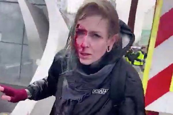 Wanita yang berasal dari Ceko, Belanda itu dilaporkan harus mendapatkan 15 jahitan di kepalanya setelah semburan air mendorongnya dengan keras ke sisi sebuah bangunan.
