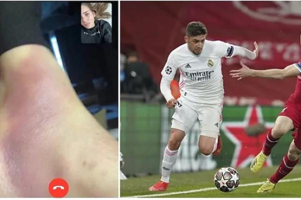 Tak banyak yang tahu bahwa pemain Real Madrid, Fede Valverde melewati pertandingan kontra Liverpool pada Kamis (15/4) dini hari tadi, dengan menahan rasa sakit di kakinya.