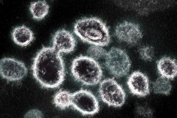 Bukan Mitos, Ini 7 Alergi Paling Tak Masuk Akal di Dunia