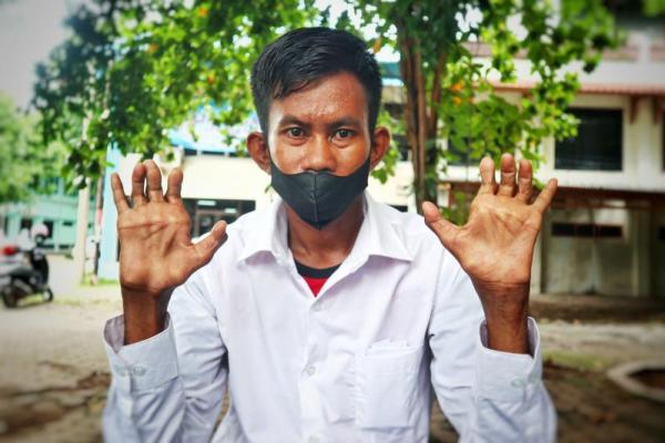 Rusdin berperawakan kurus dengan kulit coklat gelap. Rambutnya dipotong tipis di bagian samping dengan poni sekira 10 sentimeter di sisir ke arah kanan. Dan bila diperhatikan saksama, dia hanya bertumpu pada satu kaki.