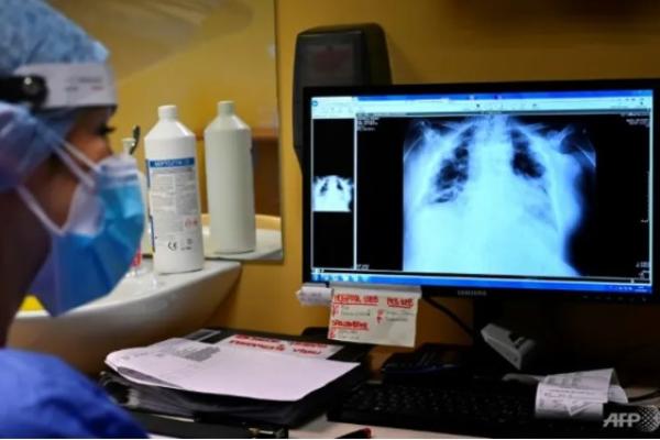 Kasus Tuberkulosis Naik Lagi Setelah Lebih dari 20 Tahun.