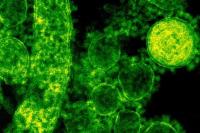 WHO Prediksi Kasus MERS akan Meningkat di Timur Tengah