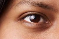 Ikuti Langkah Ini untuk Menghilangkan Mata Panda