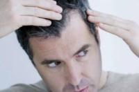 Tanpa Disemir, Ini Bahan Alami untuk Menghilangkan Uban