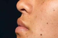 Bahan Alami yang Ampuh Hilangkan Flek Hitam Membandel