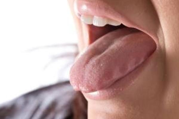 Permen karet yang mengandung xylitol efektif untuk melawan bau mulut.