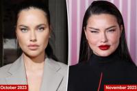 Supermodel Adriana Lima Balas Komentar Haters soal Facelift