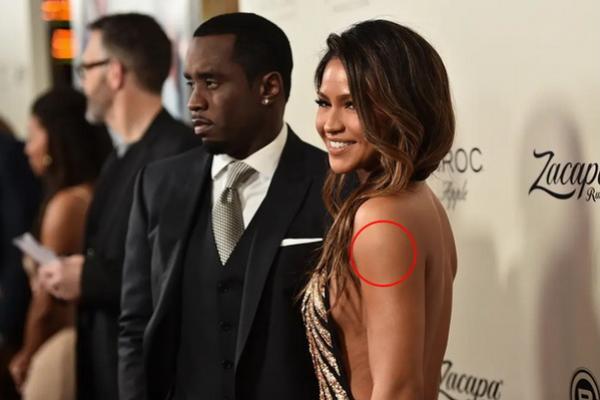 Serangan Brutal Sean Diddy Combs, Tubuh Cassie Ventura Penuh Lebam