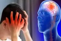 Stroke di Usia Muda Meningkat, Kenali 6 Kebiasaan yang Bisa Mencegahnya