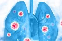 Kebiasaan Sepele yang Bisa Berujung Penyakit Pneumonia