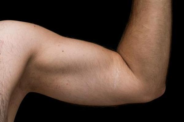 Risiko Tersembunyi di Balik Kebiasaan Mencukur Bulu Ketiak