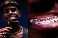 Kawat Gigi Lamine Yamal Kini Jadi Artefak, Apa yang Membuatnya Begitu Istimewa?