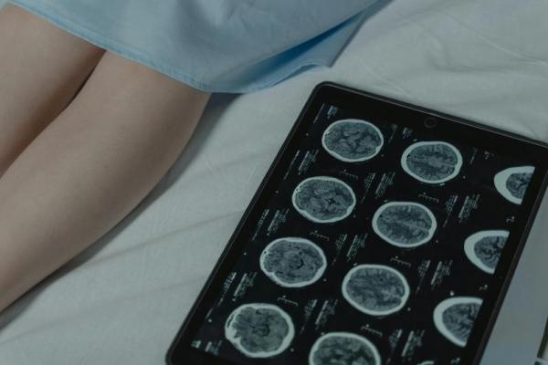 Ilmuwan Temukan "Saklar Molekuler" yang Bisa Ubah Sel Kanker Jadi Normal