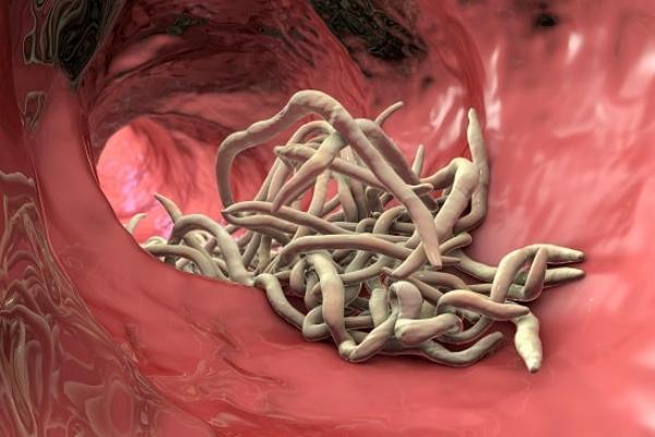 Mengenal Ascariasis, Infeksi Cacing Gelang yang Renggut Nyawa Balita di Sukabumi
