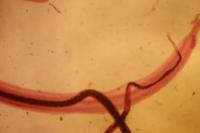 Ilmuwan Temukan Cacing Parasit yang Bisa Matikan Rasa Sakit