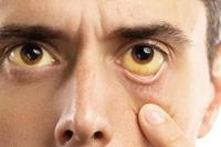 Tujuh Kebiasaan Buruk yang Bikin Mata Minus