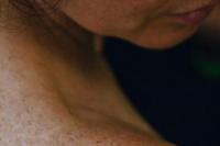 7 Tips Menghilangkan Jerawat di Punggung