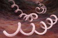 Kerangka Manusia Purba Ungkap Jejak Sifilis 5.500 Tahun Lalu