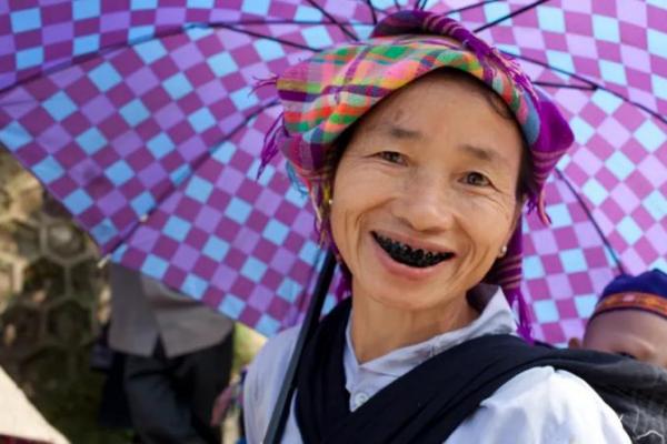 Rahasia Gigi Hitam Zaman Besi Terungkap dari Tengkorak Kuno Vietnam