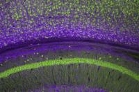 Ilmuwan Kini Bisa "Mengedit" Sirkuit Otak untuk Meningkatkan Daya Ingat